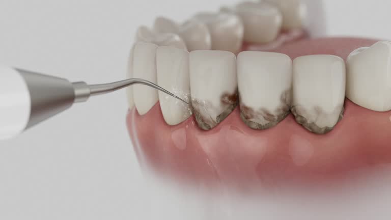 Reliable Dental Implants contractor in Marquette, MI by Smile Center Dentistry